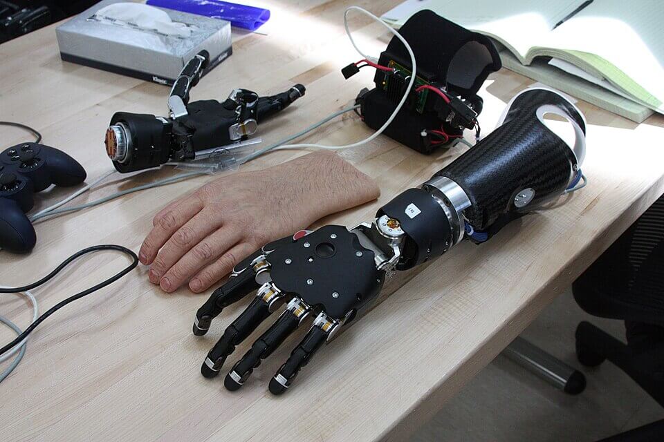 prosthetic arm