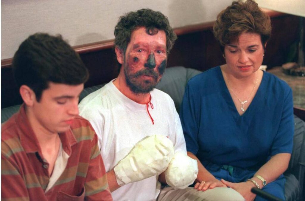 Rescued injured beck